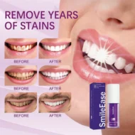 purple teeth whitening serum before after smile
